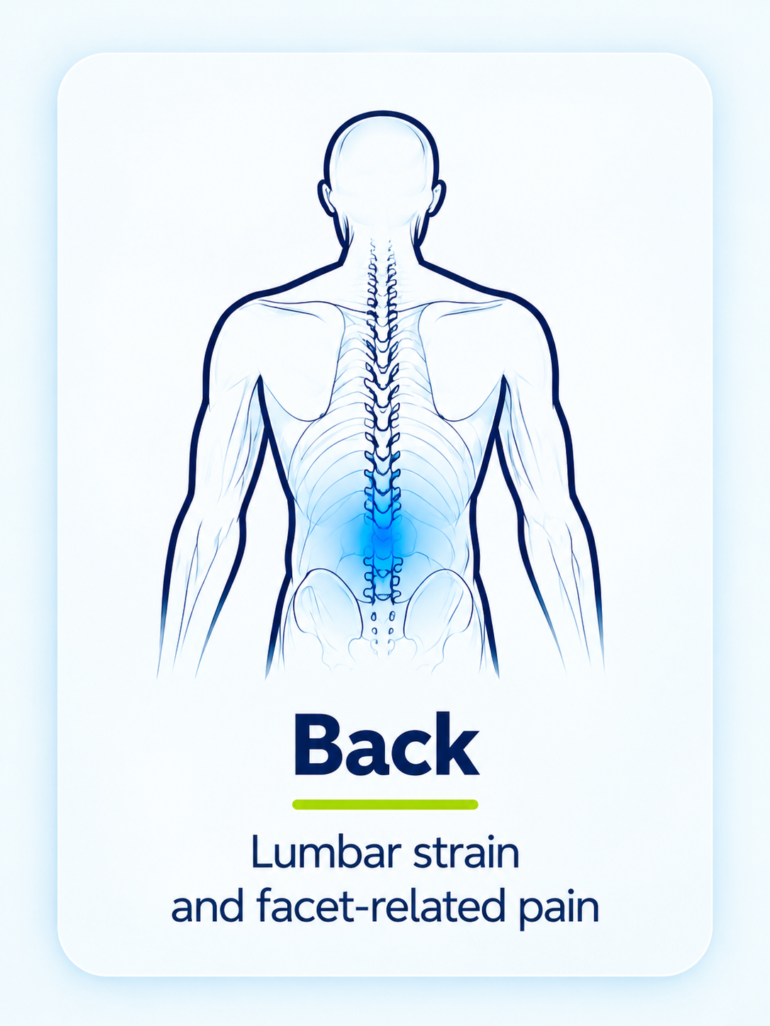 Back - Lumbar strain and facet-related pain